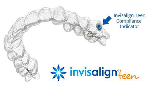 invisalign teen Talavera